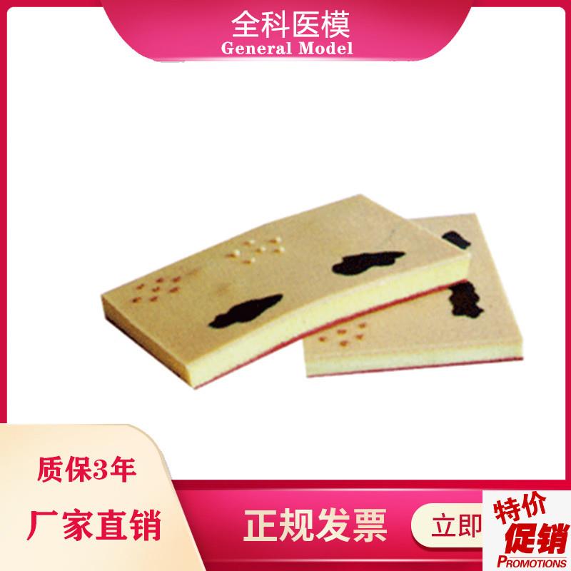 表皮常见病表处理训练模块GMO/W00103