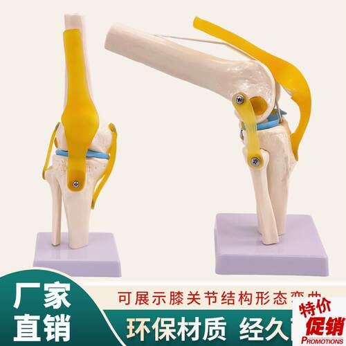 膝关节模型人体膝盖骨骼韧u带髌骨半月板结构造医学院骨科教学模