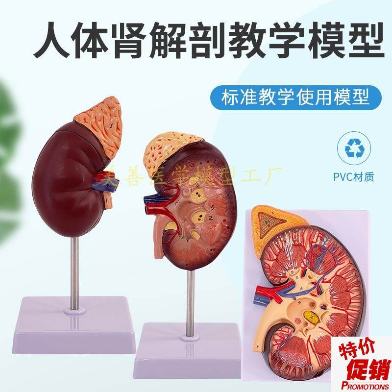 人体肾脏模型肾解剖附r肾上腺放大模型病变肾脏内脏器官解剖3倍