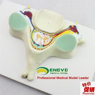 颐诺正品第五颈椎脊髓和脊神经放大模型脊髓横T断解剖颈椎模型