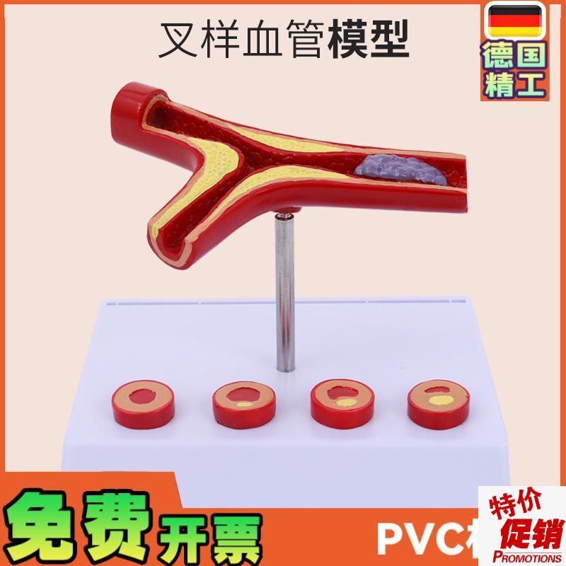人体血管解剖模型血管模型动脉(硬)化L展示各阶段年龄层血管