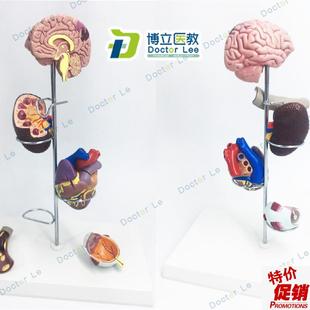进口人体高血压模型并发症心脏模型J肾脏模型眼睛模型脑模型