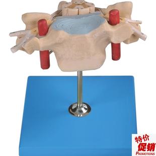 颈椎附脊髓和脊神经放大K模型A18105