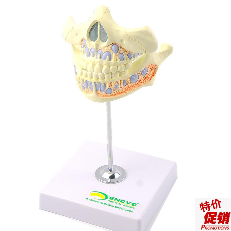ENOVO颐诺乳牙牙列模型儿y童口腔齿科牙医培训教学医生教具乳牙