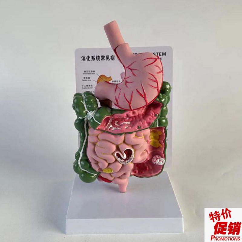 康泰医用模型食j管胃肠道病变桌上型医患示教消化道医药促销直播