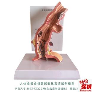 人体食管食道胃部消化系统解剖模型教G学内脏解剖人体教具厂家直