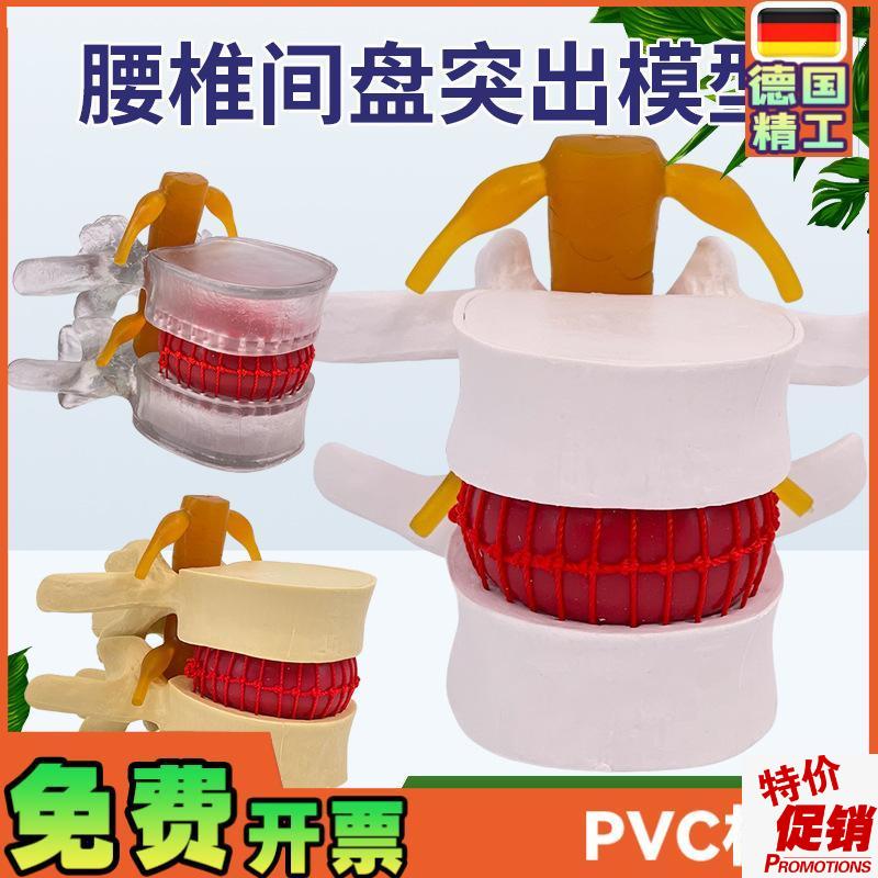 腰椎模型教学医学人体腰椎间z盘受压演示脊柱骨突出病理骨质教具