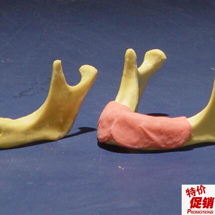 ENOVO颐诺下颌骨种植t操作模型口腔种植口腔齿科培训实训操作模