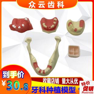 上颌窦提升操练模型种植牙练习模H型口腔种植软牙龈齿科材料