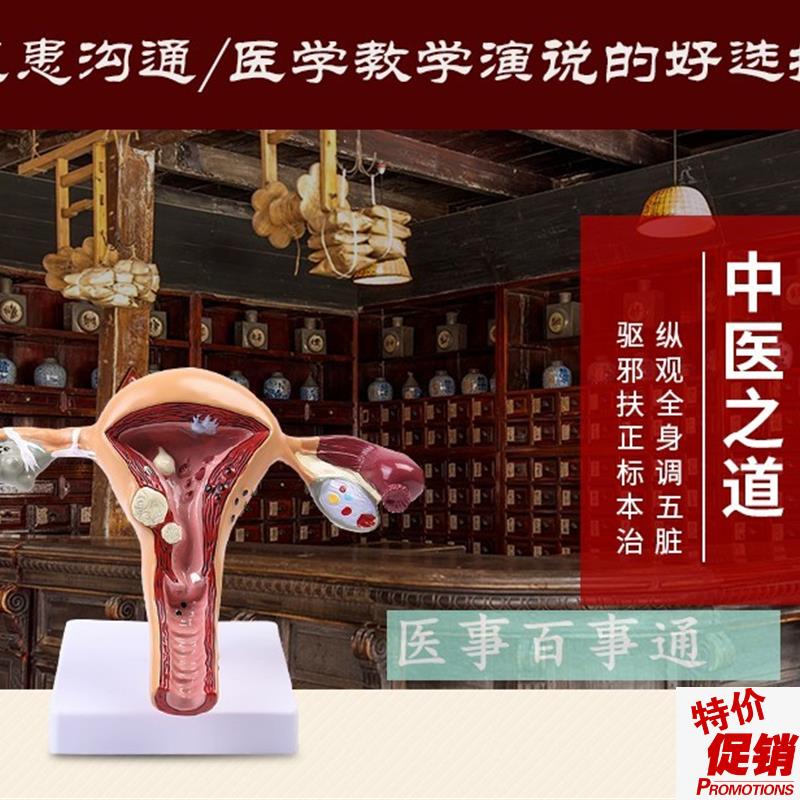 人体子宫解剖模型子宫模型子宫癌变输卵管N狭窄综合疾病科普教育