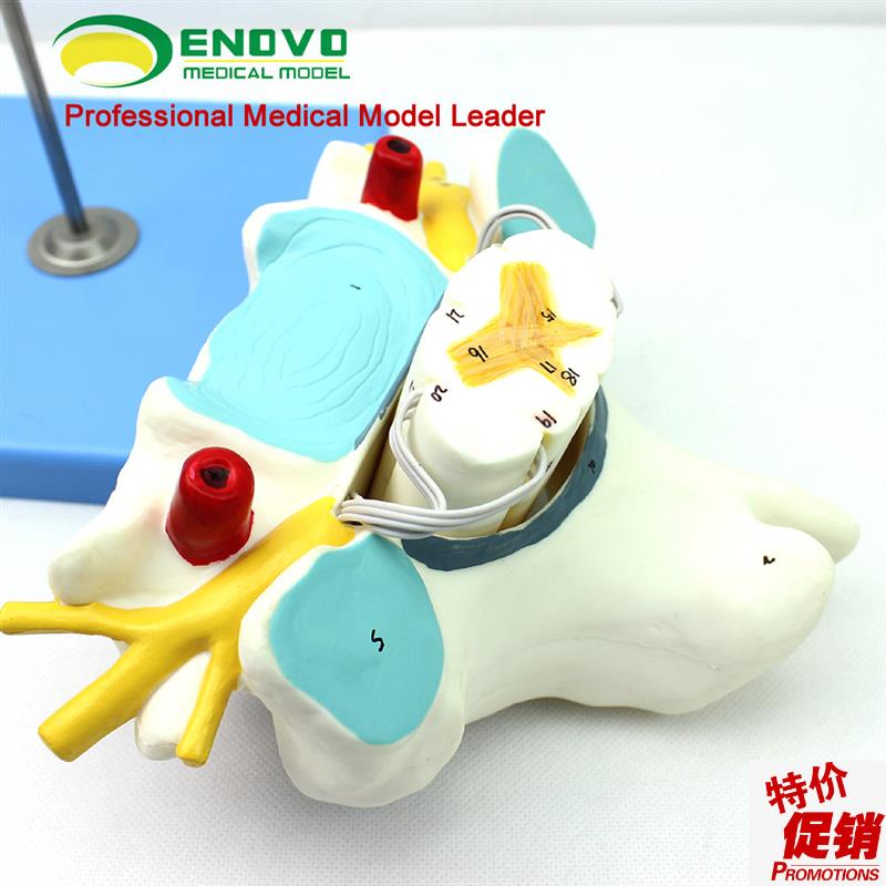 颐诺正品医用人体l颈椎附脊髓和脊神经放大模型神经骨科解剖模型