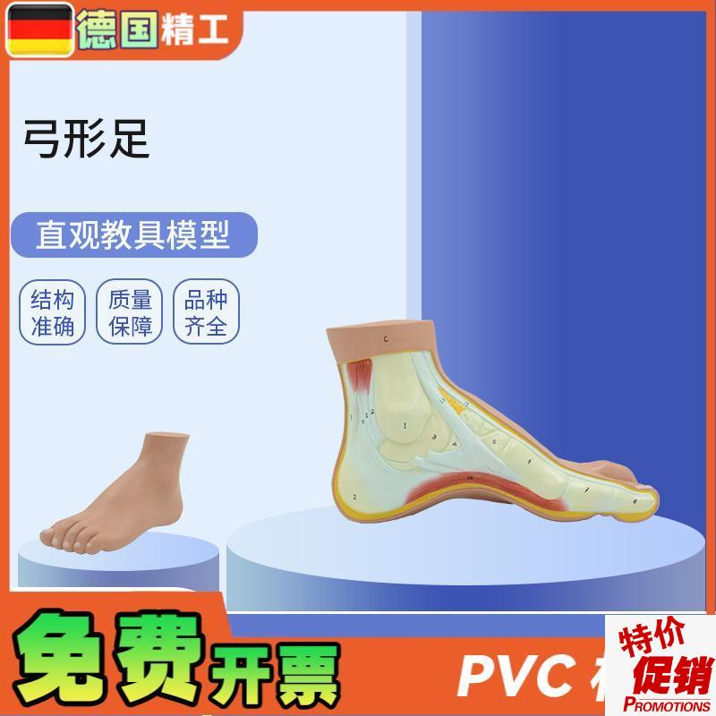 德国】PNT-0727弓t形足模型足部病理模型人体足部解剖模型脚关