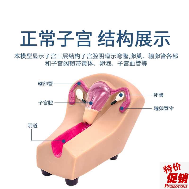 女性宫内避孕及训练模型女性节育计生模型女性X宫内避孕模型