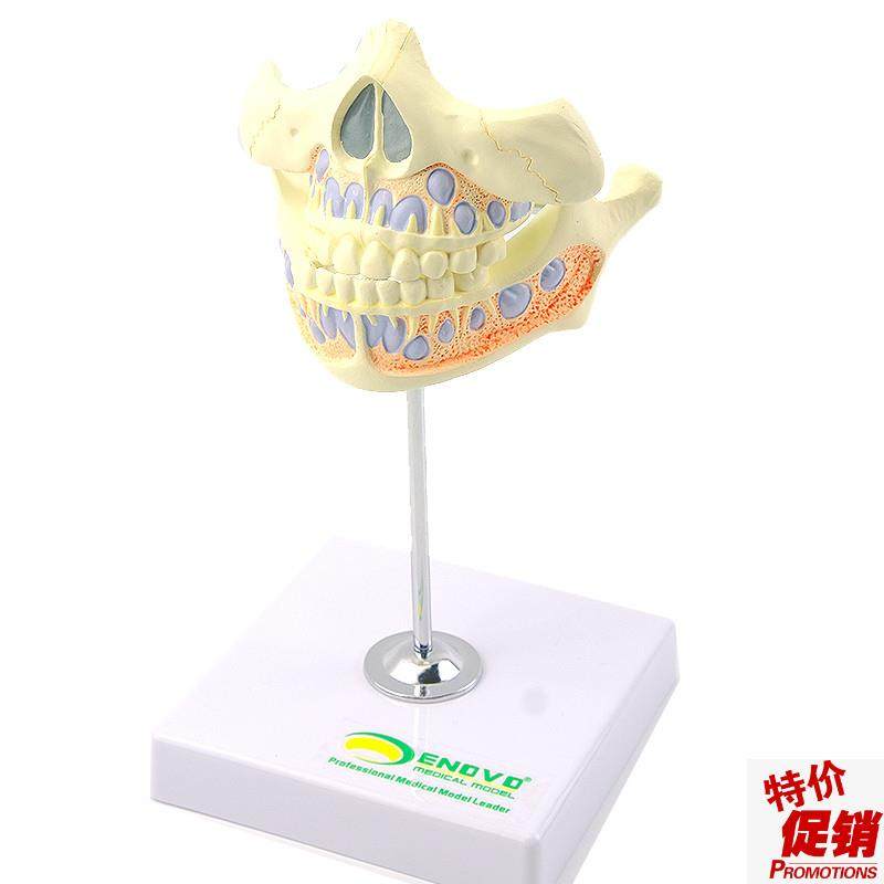 ENOVO颐诺乳牙牙列模型儿童B口腔齿科牙医培训教学医生教具乳牙,文具电教/文化用品/商务用品,教学标本/模型,淘宝优惠券,粉丝福利购,淘宝优惠卷