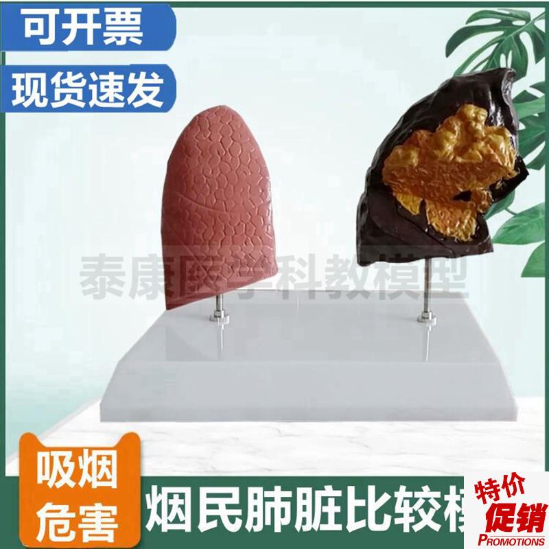 爱国卫生运动教j育模型禁烟警示展示吸烟有害健康模型危害人体器