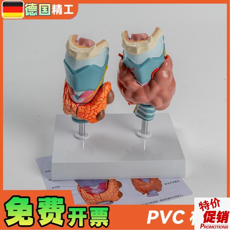 德国】人体病理甲状腺模型甲亢甲低D内分泌系统医学解剖甲状腺喉