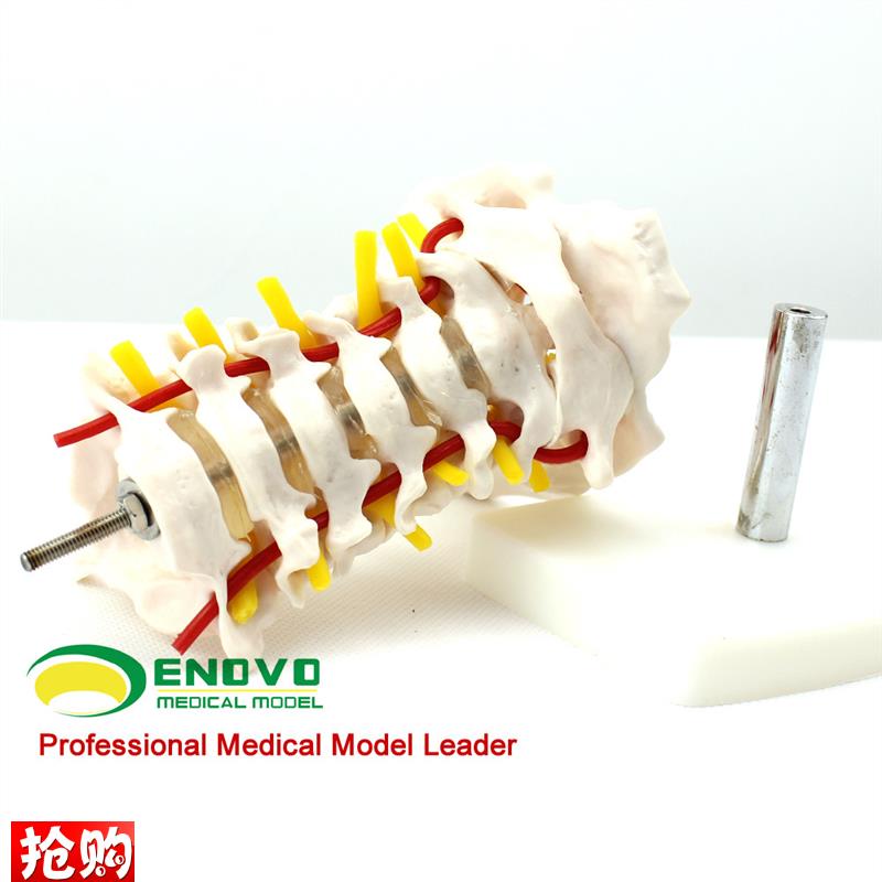 ENOVO颐诺人k体颈椎颈动脉模型颈椎模型寰枢关节人体骨骼标本模