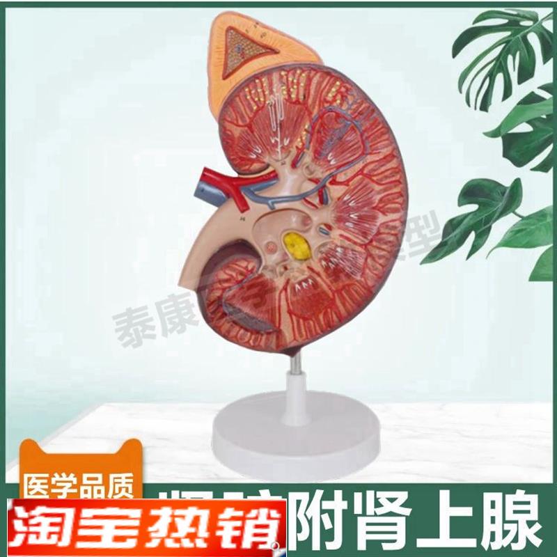 人体肾脏模型肾上腺放大审v单位肾小球蛋白尿形成尿液泌尿器官病