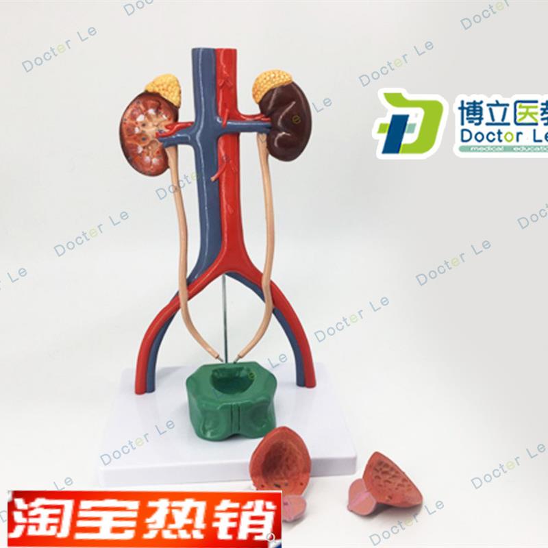 人体泌尿系统模型肾输尿管膀胱B尿道解剖模型医学泌尿科泌尿模型