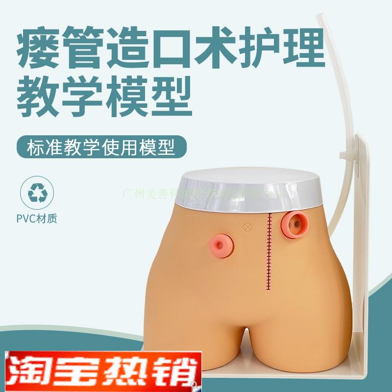 造口模型高级瘘管造口术护理模型结肠I回肠造瘘教学模型造口冲