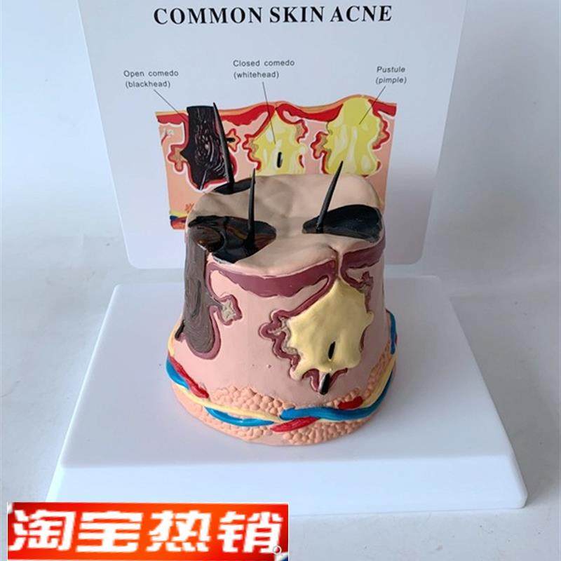 放大皮肤结构解剖模型组织层次皮肤构H造模型具微整形缝合美容教