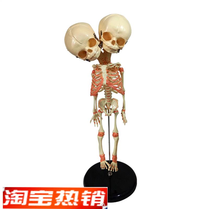 婴儿骷髅模c型双头婴儿畸形骨骼骨架人骨素描人体教学医用教仪35C