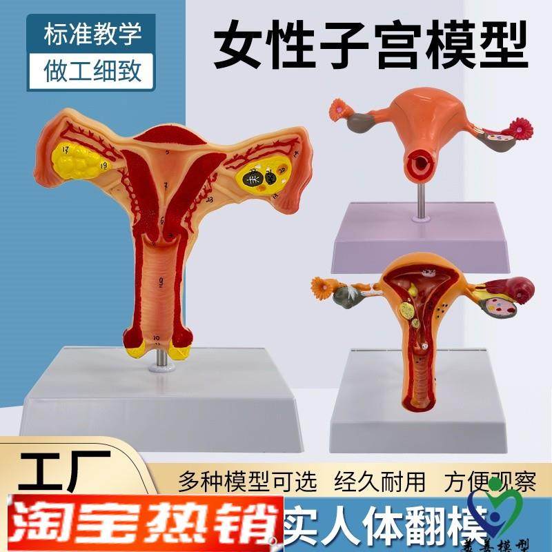 人体子宫模型女性生殖模型阴道卵B巢模型教学模具病理变化科学教