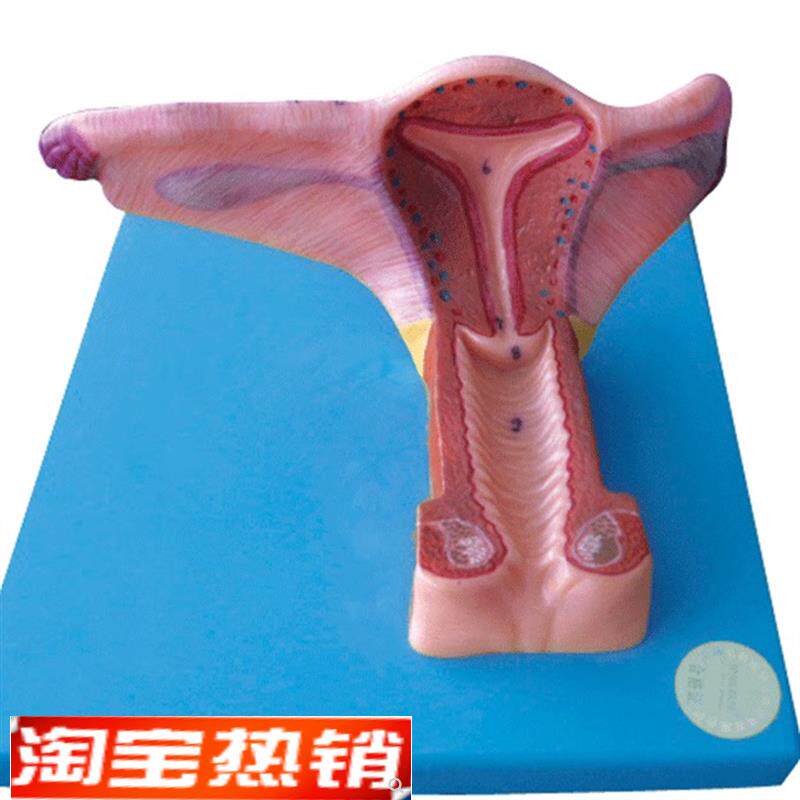 女性内生殖器官模型/解剖K模型A15108