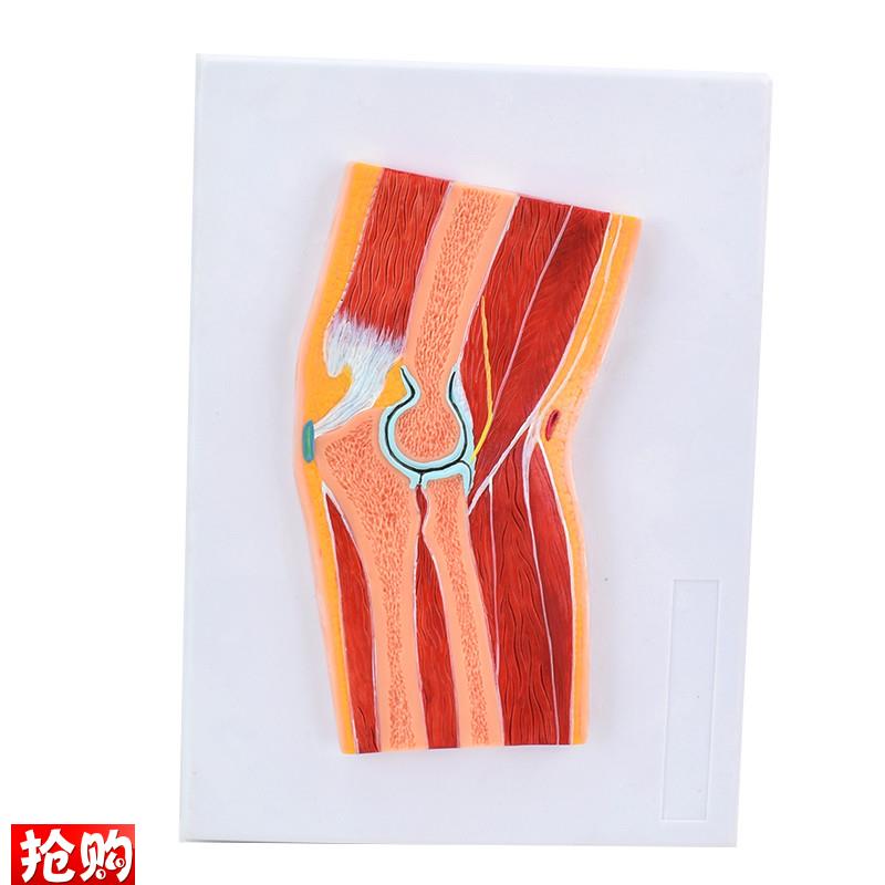 ENOVO颐诺医学解剖肘关节骨骼肌肉模型肘关节剖面R肘关节构造MRI