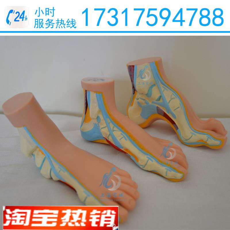 正常足扁平I足弓型足模型