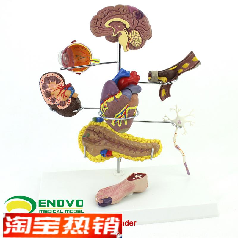 ENOVO颐诺人体医学糖尿病模型并发F症大脑心脏胰腺神经元足内外科