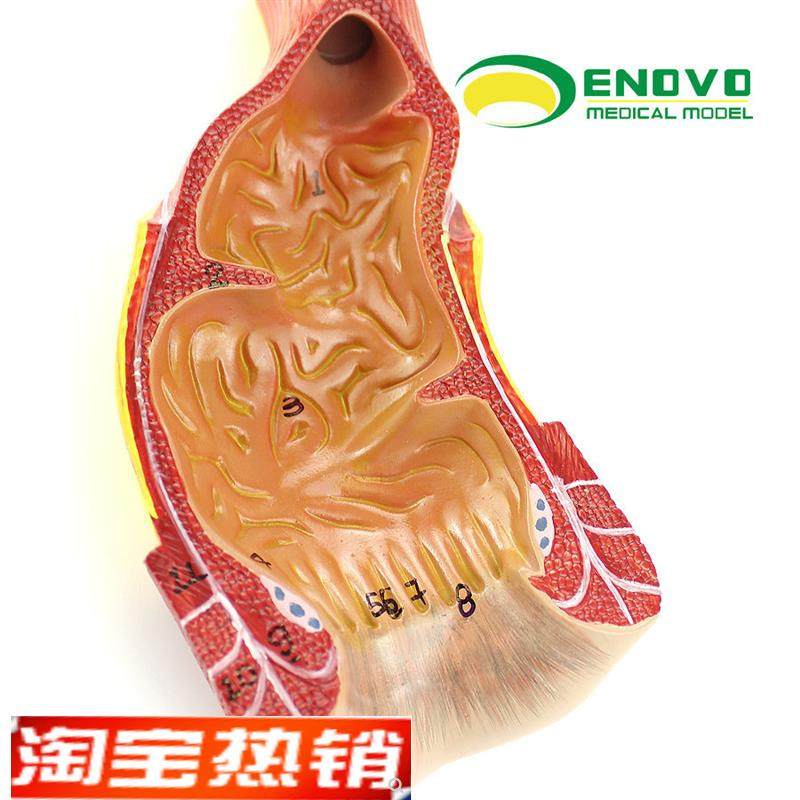 ENOVO颐诺医学人体直肠肛管肛门F解剖结构模型肛肠科外科普外科,文具电教/文化用品/商务用品,教学标本/模型,淘宝优惠券,粉丝福利购,淘宝优惠卷