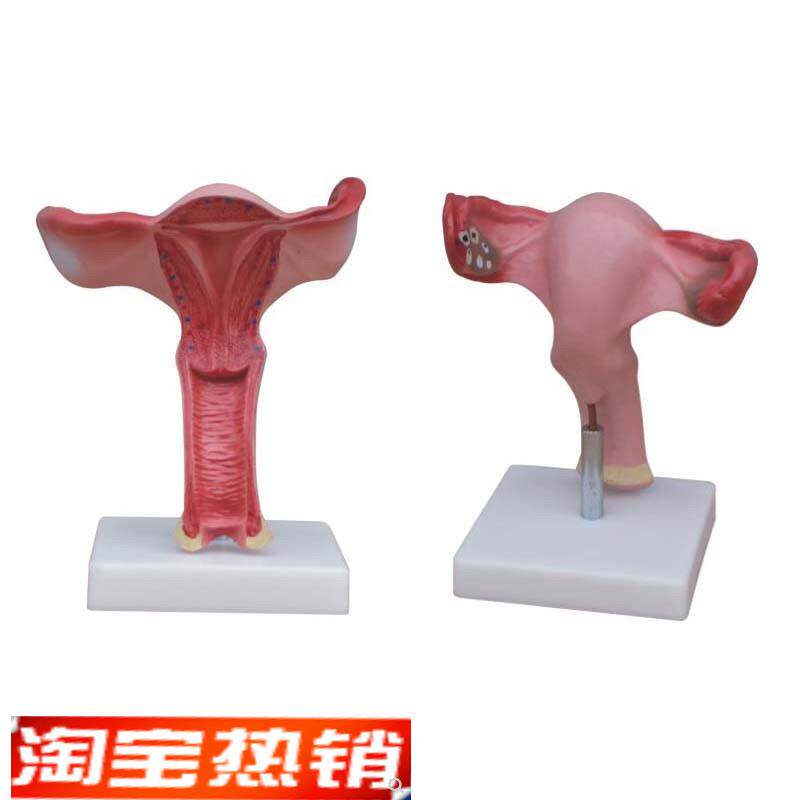 医用人体女性子y宫放大解剖示教模型