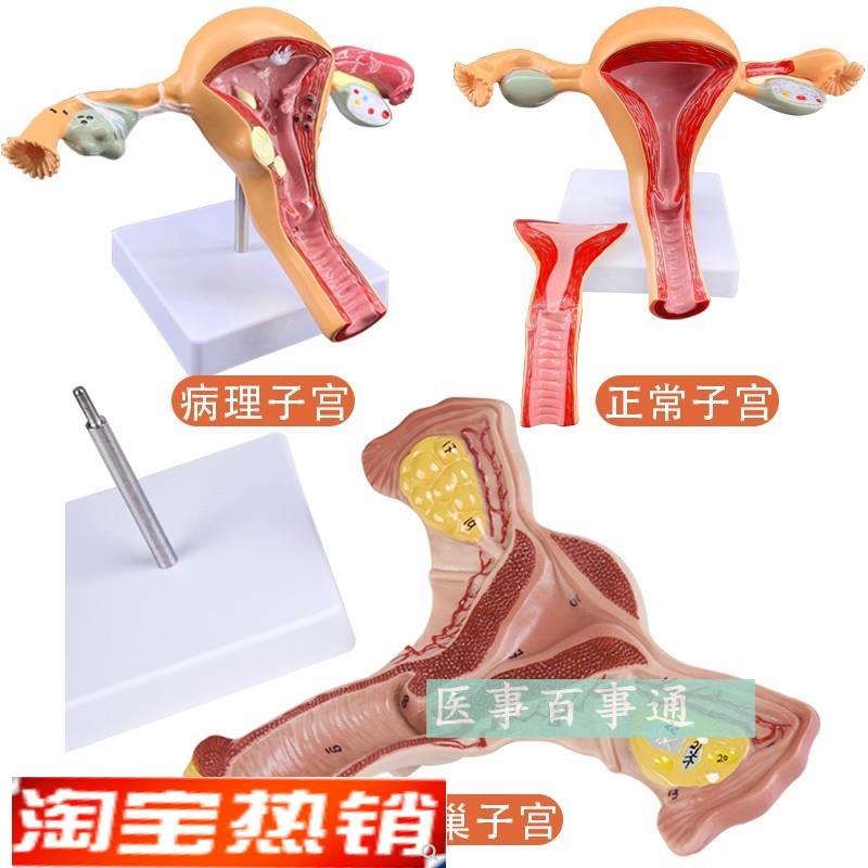 子宫模型女性g内生殖器官生殖结构妇科模型子宫解剖模型示教模型
