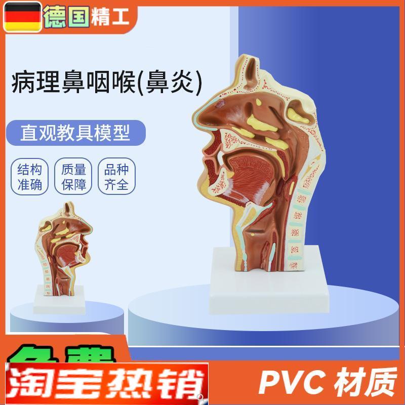 德国】PNdT-0737鼻咽喉咽喉口鼻矢状解剖耳鼻喉科五官教学模型