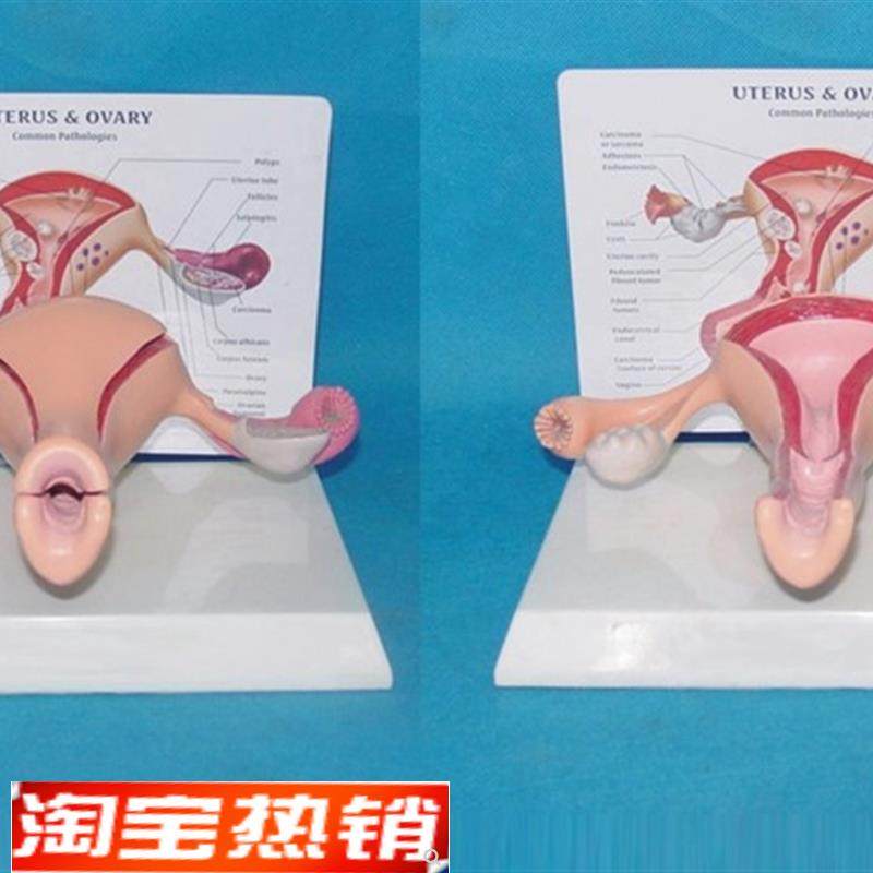 包邮子宫卵巢(健康)模型生殖器解剖计生V医用教学讲解,玩具/童车/益智/积木/模型,其他模型玩具,淘宝优惠券,粉丝福利购,淘宝优惠卷