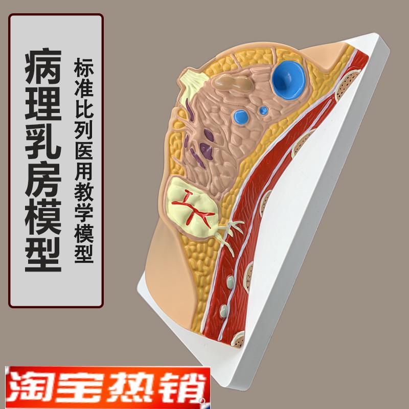 女性病理乳房模型人体1:1乳房模型乳腺解剖T女性医院教学教具