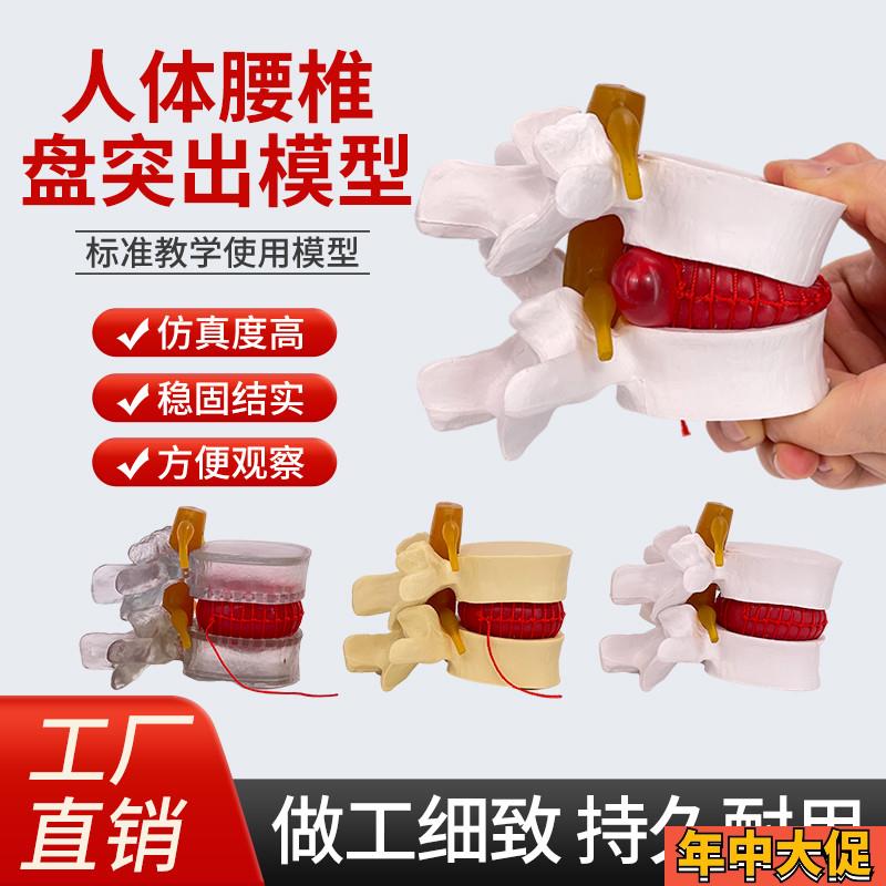 仿真腰椎模型 椎间盘 1:1人体骨骼F脊柱脊椎解剖医用教学骨架标本