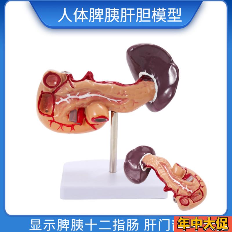 教学仿真人体胰脾肝胆十二指肠模型1H:1自然大普通胰腺内脏标本