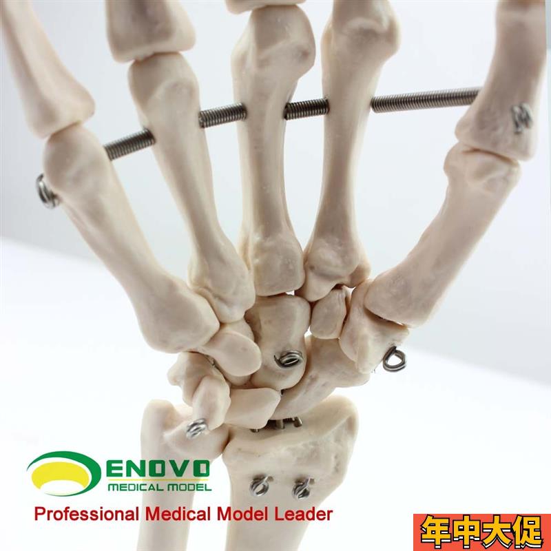 ENOVO颐诺医学人体手关节模型手骨尺骨桡骨模型人U体骨骼手足外科