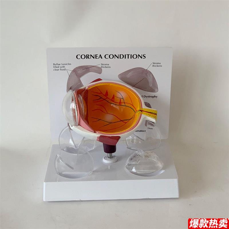 眼球模型角膜病变眼睛视力检查体检教视网膜F眼底眼科医药促销礼