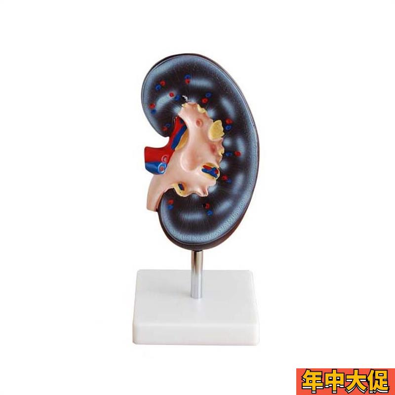 人体肾解剖模型1r件肾解剖展示模型人体肾展示模型