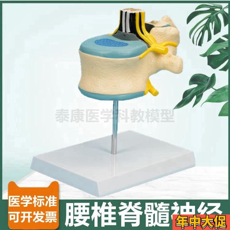 腰椎解剖模型椎管脊髓神經(jīng)根蛛網(wǎng)膜軟脊膜麻醉O科教學(xué)中樞周圍神