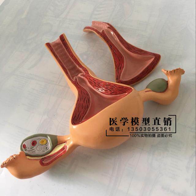 女性子宫模型 卵巢模型 女性阴道 女性内生殖器解剖模型. 妇科教