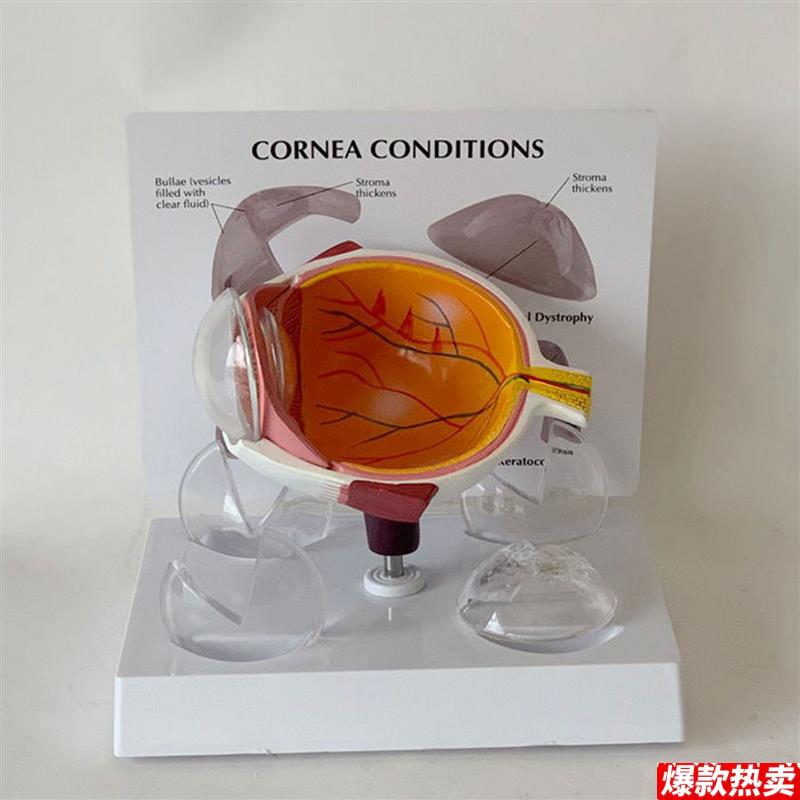 泰康眼科教学模型病理角膜视网膜血h管神经晶状体视神经眼科医用