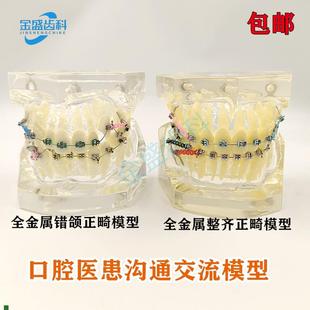 牙科模型正畸结扎丝托槽口腔教学模型牙齿错颌矫正X展示透明牙模