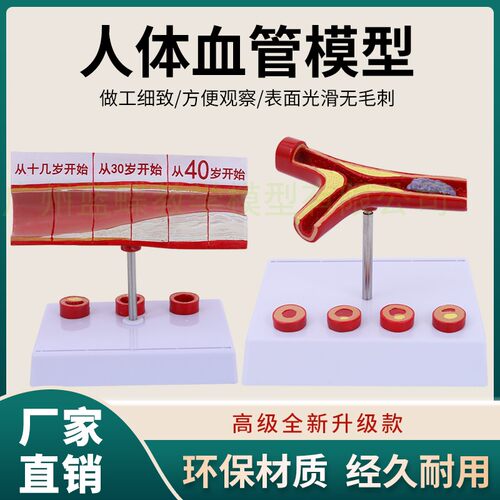 人体支脉硬化粥样 心血管硬化动脉模型 血全T模型人体血管模型