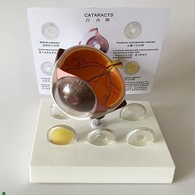 白内障眼b睛模型晶片虹膜器官解剖光学教仪医用医学教学教具包邮