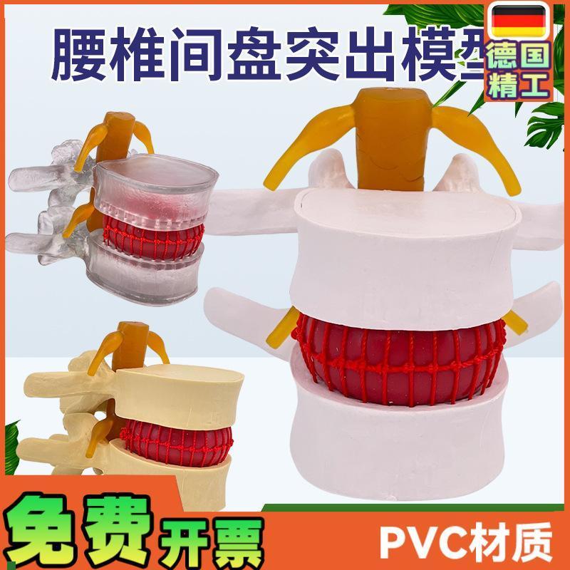 腰椎模型教学医学人体腰s椎间盘受压演示脊柱骨突出病理骨质教具