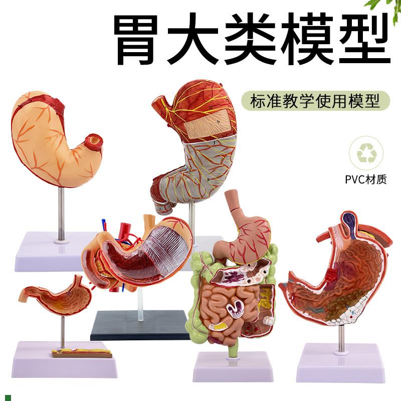 病理胃模型人体胃的穿孔病态胃模型消化科胃R冠状剖面解剖放大